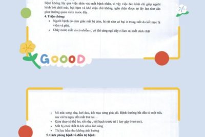 TĂNG CƯỜNG TUYÊN TRUYỀN CÔNG TÁC PHÒNG CHỐNG BỆN ĐAU MẮT ĐỎ